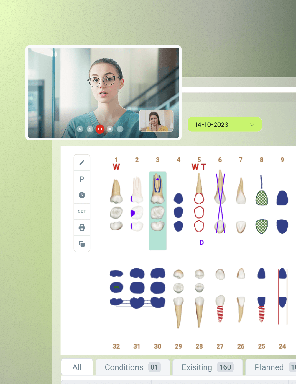 Ease of Use Ease of Use